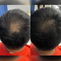 فکرمی کنن کلاه گیسه