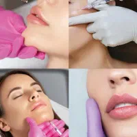 تزریق فیلر صورت. کیس آلبوم