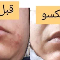 زیبایی پوست و مو|آرایشی، بهداشتی، درمانی|سنندج, |دیوار