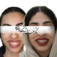 ارتودنسی با شرایط اقساط و منعطف|خدمات آرایشگری و زیبایی|تهران, دزاشیب|دیوار