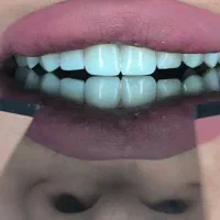 خدمات دندان پزشکی و دندان سازی|خدمات آرایشگری و زیبایی|زنجان, |دیوار