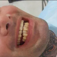 کامپوزیت واحدی ۸۰۰