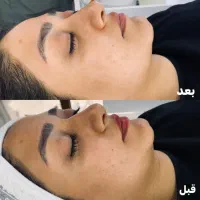 خدمات تخصصی پوست در محدوده ولیعصر|خدمات آرایشگری و زیبایی|تهران, بلوار کشاورز|دیوار