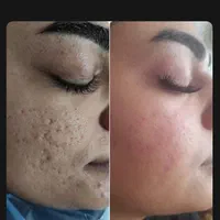 آموزش صفر تا صد فیشیال تخصصی و فوق تخصصی|خدمات آموزشی|اصفهان, سعادت‌آباد|دیوار