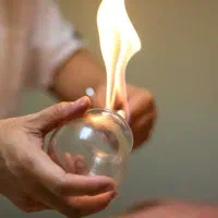 حجامت بادکش زالو فصد در منزل