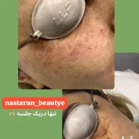 ژل بدن وصورت آموزش  تزریق دراهواز|خدمات آرایشگری و زیبایی|اهواز, کیانپارس |دیوار