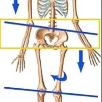 درمان دستی دیسک کمر