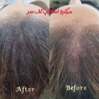 کم پشتی موهات با میکرواسکالپ، کبودی لبات با شیدینگ|خدمات آرایشگری و زیبایی|کاشان, مفتح|دیوار