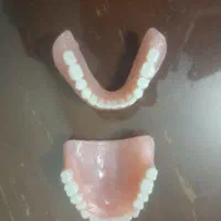 ساخت دندان مصنوعی ایرانی و خارجی