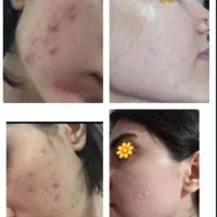 محصولات زیبایی پوست و مو برای پر پشت ک..مو