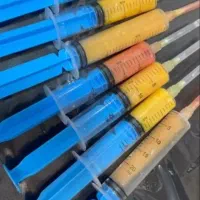 تزریق چربی به صورت وساکشن شکم وپهلو|خدمات آرایشگری و زیبایی|نهاوند, |دیوار