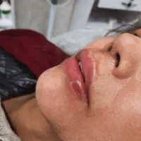 جشنواره ژل و بوتاکس و مزوتراپی لک وجوانسازی بانوان|خدمات آرایشگری و زیبایی|اصفهان, عسگریه|دیوار