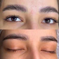 پاک تتوریموو تتو در کیلینیک بدون درد /ریمو ابرو