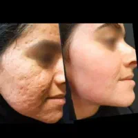 بینظیر|آرایشی، بهداشتی، درمانی|خرم‌آباد, |دیوار