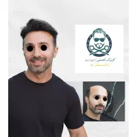 پرپشتی مو ترمیم مو بدون عوارض پروتزمو