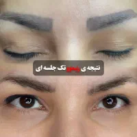 تخصصی پوست و مو و لیزر