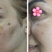 نمایندگی رسمی صابون سفیدکننده(اصل)