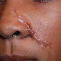 پی بی سرم کانتورینگ|خدمات آرایشگری و زیبایی|رشت, بلوار گیلان|دیوار