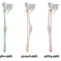 کلینیک تخصصی بهبود غیرجراحی انحرافات زانو|خدمات آرایشگری و زیبایی|بهار, |دیوار
