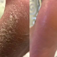 آموزش پدیکور و پارافین تراپی و ارتونیل|خدمات آموزشی|اصفهان, مرداویج|دیوار