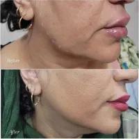 خدمات و آموزش تخصصی ژل و بوتاکس|خدمات آرایشگری و زیبایی|کرج, کیانمهر|دیوار