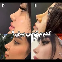 تزریق چربی، بلفاروپلاستی پلک، بینی اتوپلاستی گوش|خدمات آرایشگری و زیبایی|تهران, ستارخان|دیوار