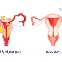 درمان تضمینی وقطعی مشکلات رحم|آرایشی، بهداشتی، درمانی|قم, نیروگاه|دیوار