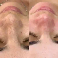 فیشیال تخصصی