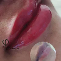 آرایش دائم صورت تخفیف ویژه فقط به مدت ۱۰ روز