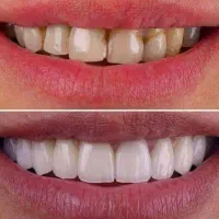 استخدام لابراتوار دندانسازی هنرجو و پیک موتور