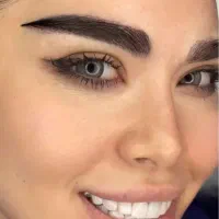 کاشت مو ابرو ریش سیبیل در مشهد توسط متخصص پوست