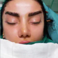 تخفیف عمل بینی لیفت/لیپو/ابدو/رفع غبغب/دایرکت ابرو|خدمات آرایشگری و زیبایی|پاکدشت, شهرک انقلاب|دیوار