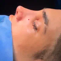 جشنواره زیبایی بینی