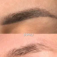 ریمو ابرو فقط تو یک دقیقه بدون زخم دوره نقاهت|خدمات آرایشگری و زیبایی|کاشان, زیدی|دیوار