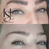 میکرو،، فیبروز