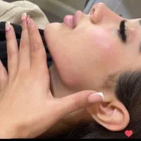 لیزر فشیال پلاژن فیلر پی ارپی هایفو برداشتن خال