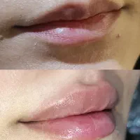تخفیف ۵۰درصدی بلفارو پلاستی توسط پزشک|خدمات زیبایی و سلامت|کرمانشاه, |دیوار