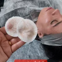 مدل فیشیال تخصصی هزینه مواد گرفته میشود|خدمات آرایشگری و زیبایی|همدان, |دیوار