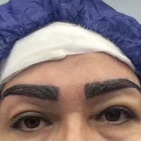 نیازمند مدل رایگان کاشت ابرو