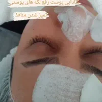 فشیال تخصصی و پاکسازی پوست در محیطی لوکس و آرام -|خدمات آرایشگری و زیبایی|قم, زنبیل آباد|دیوار