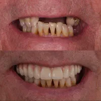 دندانپزشکی ایمپلنت اقساط ۲۴ ماهه|خدمات آرایشگری و زیبایی|تهران, میرداماد|دیوار