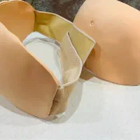 پروتز بارداری