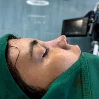 عمل زیبایی بینی|خدمات آرایشگری و زیبایی|حمیدیه, |دیوار