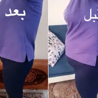 برترین روش لاغری بدون بازگشت باکرایولیپولیز