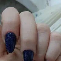 تخفیف کاشت ناخن به مدت محدود