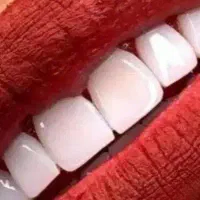 خدمات کامپوزیت درجه یک و بینظیر