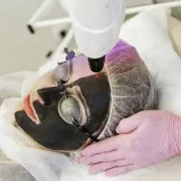 لیزر سفیدکننده و لیزرلک و ریمو تتو(تخفیف۵۰٪عیدانه)