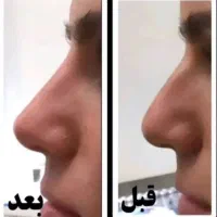 بینیتو تو ۲۰ روز کوچیک کن