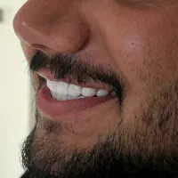 جرم گیری۱۹۰۰+رایگان