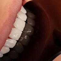 دستیار ...دندانپزشکی